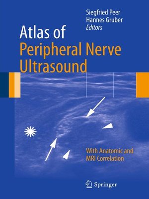 cover image of Atlas of Peripheral Nerve Ultrasound